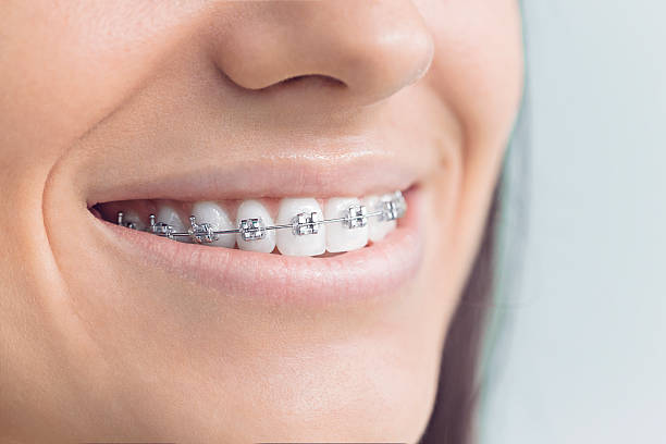 Professional  Holistic Dental Services in San Juan Capistrano, CA